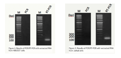 培養細胞からのRNA抽出及びRT-PCRによる検出結果(図1),培養細胞からのRNA抽出及びRT-PCRによる検出結果図2