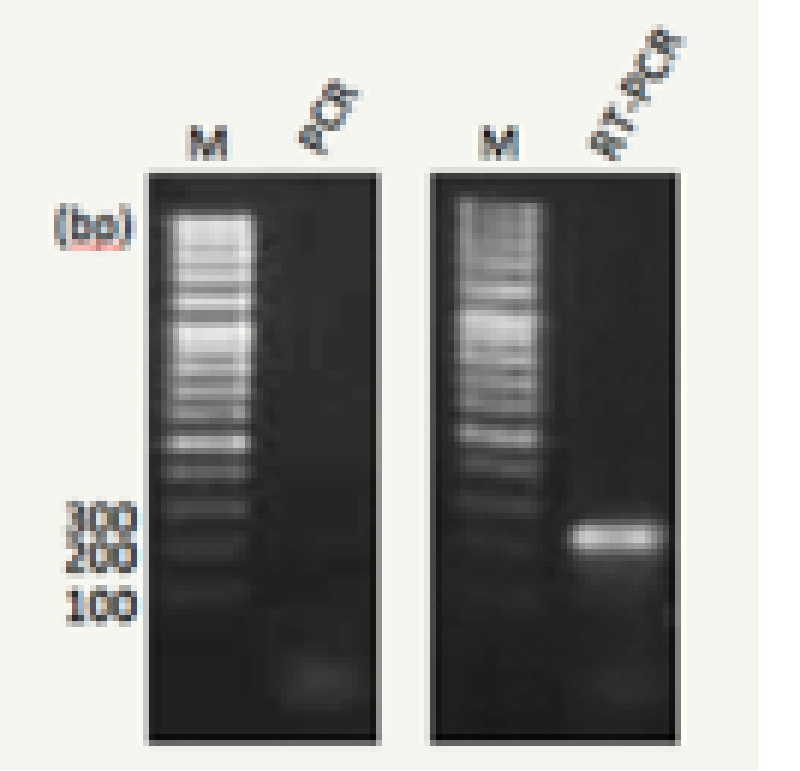 マウス血液からのRNA抽出及びRT-PCRによる検出結果